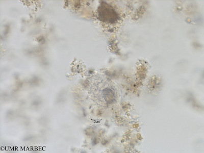 phyto/Bizerte/bizerte_bay/RISCO November 2015/Gyrodinium sp5 (Baie_T1B-Gyrodinium-2).tif(copy)_thumb.jpg